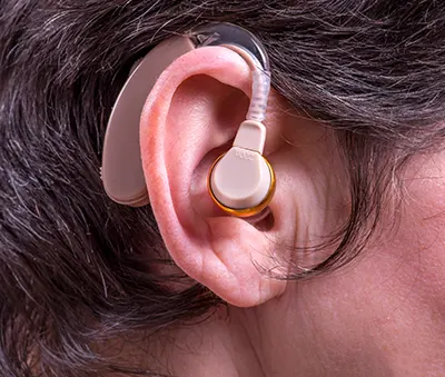 Prothèses auditives contours d’oreilles